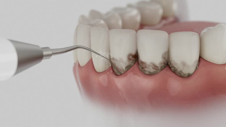 Trusted Dental Crowns And Bridges service in Simmesport, LA - Dentist Open Now